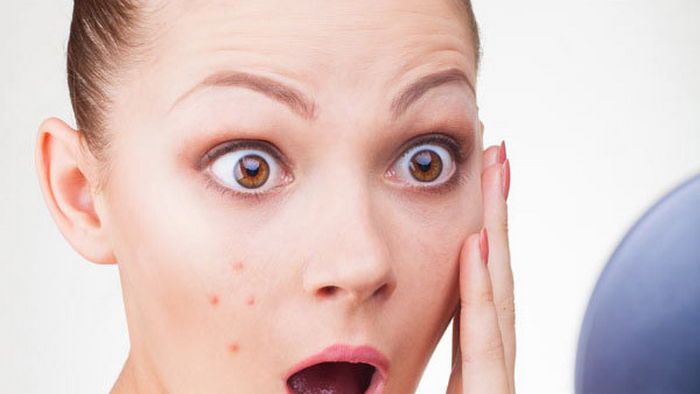 Почему на лице появляется высыпание и как с этим бороться Почему на лице появляется высыпание и как с этим бороться