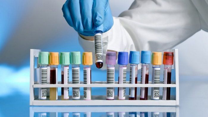 7 анализов, которые нужно сдавать каждый год 7 анализов, которые нужно сдавать каждый год