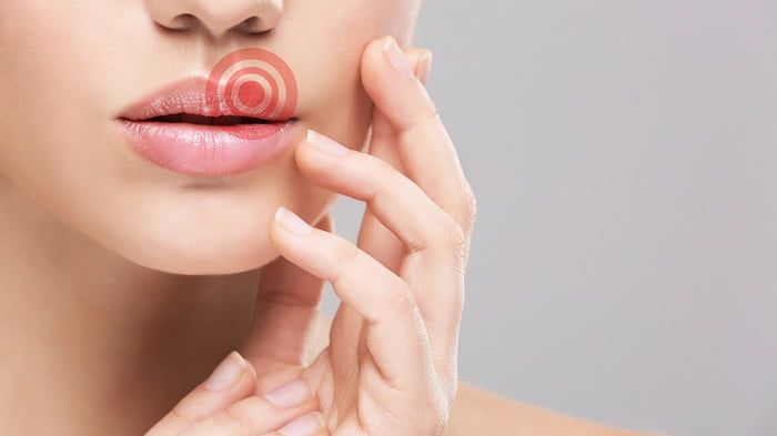 Герпес на губах: что вызывает и как лечить Герпес на губах: что вызывает и как лечить