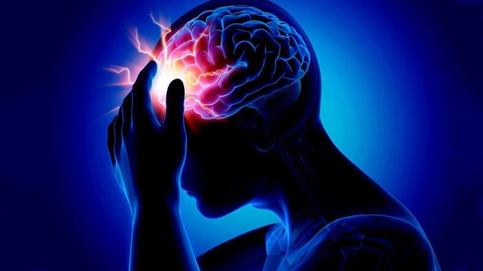 Инсульт до 40: кто находится в группе риска Инсульт до 40: кто находится в группе риска