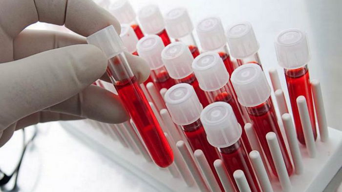 5 фактов, которые вы должны знать о своей группе крови