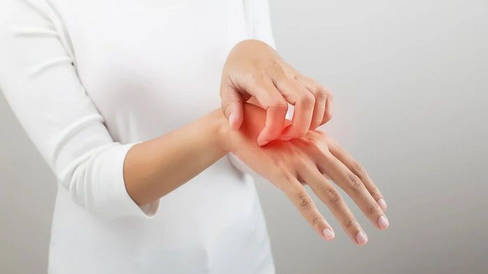 10 продуктов, которые вызывают экзему 10 продуктов, которые вызывают экзему