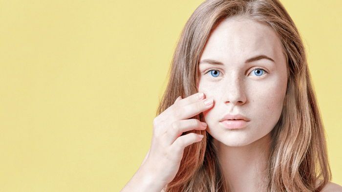 Как избавиться от угрей Как избавиться от угрей