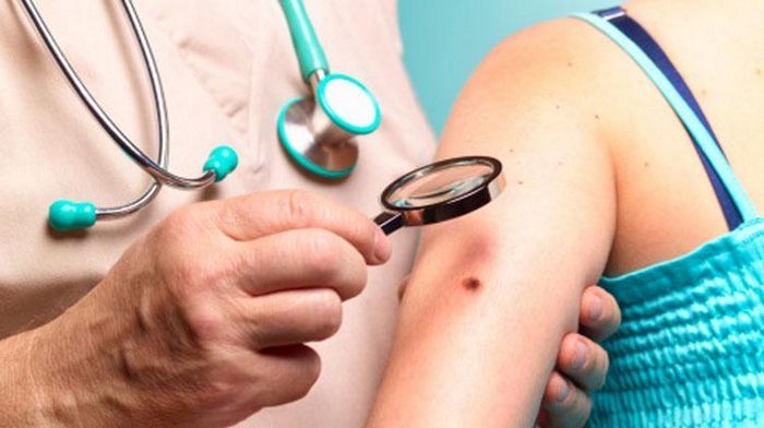 Израильский доктор Гандельман рассказал как избежать меланомы