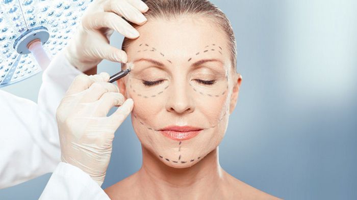 Фейсліфтинг: призначення та особливості операції
