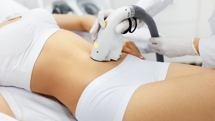 Лазерна епіляція: все, що треба знати