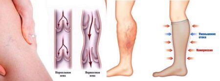 Как работают компрессионные чулки: научный взгляд на простую вещь