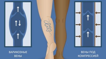 Как работают компрессионные чулки: научный взгляд на простую вещь