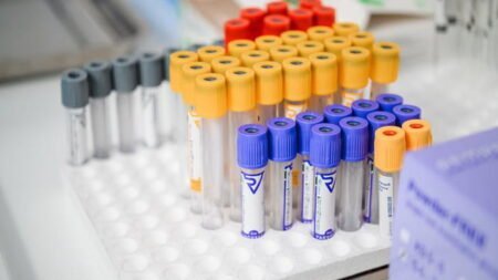 Анализ крови на ферритин