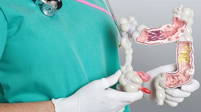 Кому и когда стоит обратиться к проктологу