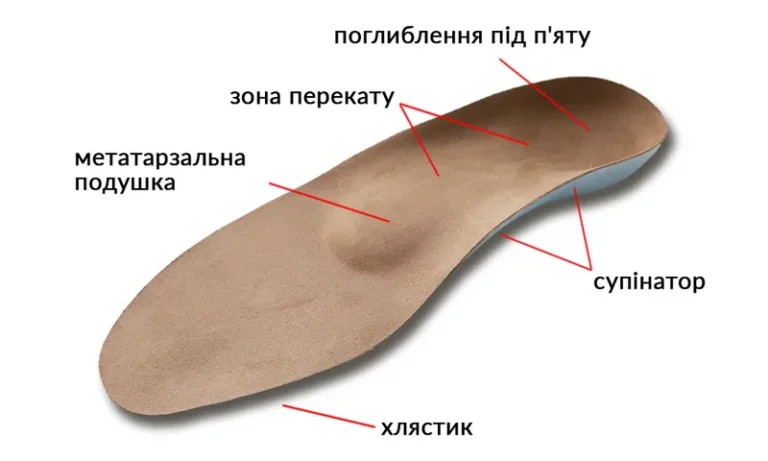 Как выбрать подходящие ортопедические стельки?
