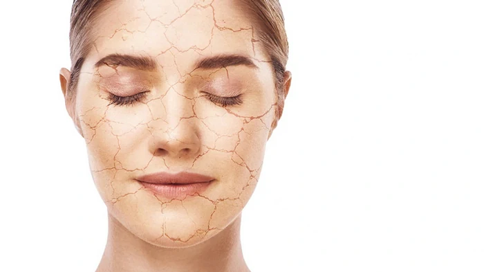 Косметолог назвала фактор, который приводит к сухости кожи, морщинам и даже акне