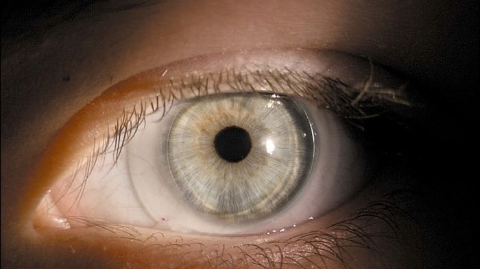 Склеральные линзы: особенности, преимущества и подбор Склеральные линзы: особенности, преимущества и подбор