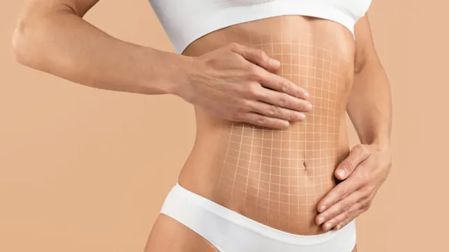 Моя история абдоминопластики: путь к новому телу и новой жизни