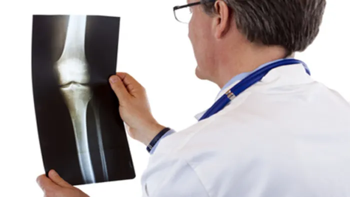 Что такое остеосклероз: причины и последствия Что такое остеосклероз: причины и последствия